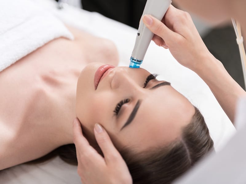 Morpheus 8 microneedling in Addison, Texas