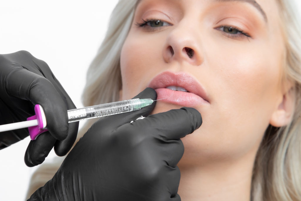 3 lip filler Woman receiving Botox lip injections at Vitalyc Medspa