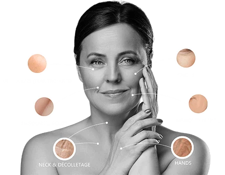 EZ Gel PRF Vitalyc Medspa Dallas TX Treatment Areas-mobile