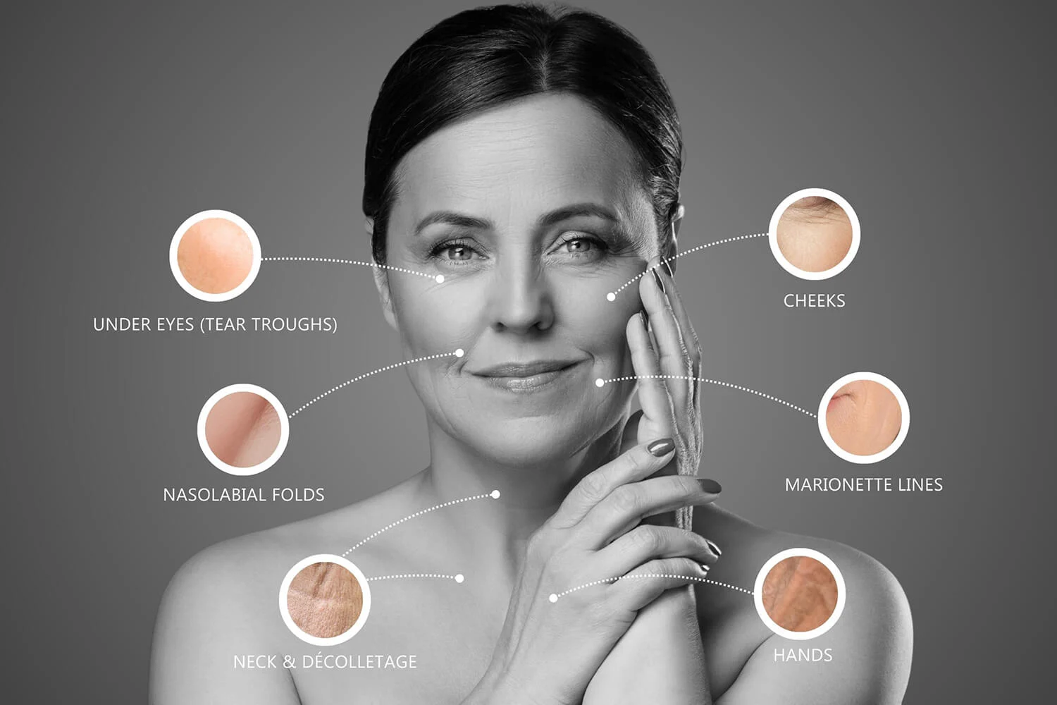 EZ Gel PRF Vitalyc Medspa Dallas TX Treatment Areas
